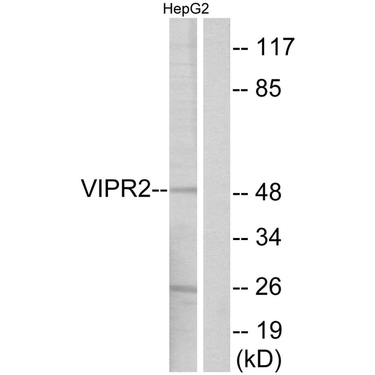 Western Blot - Anti-VIPR2 Antibody (G790) - Antibodies.com