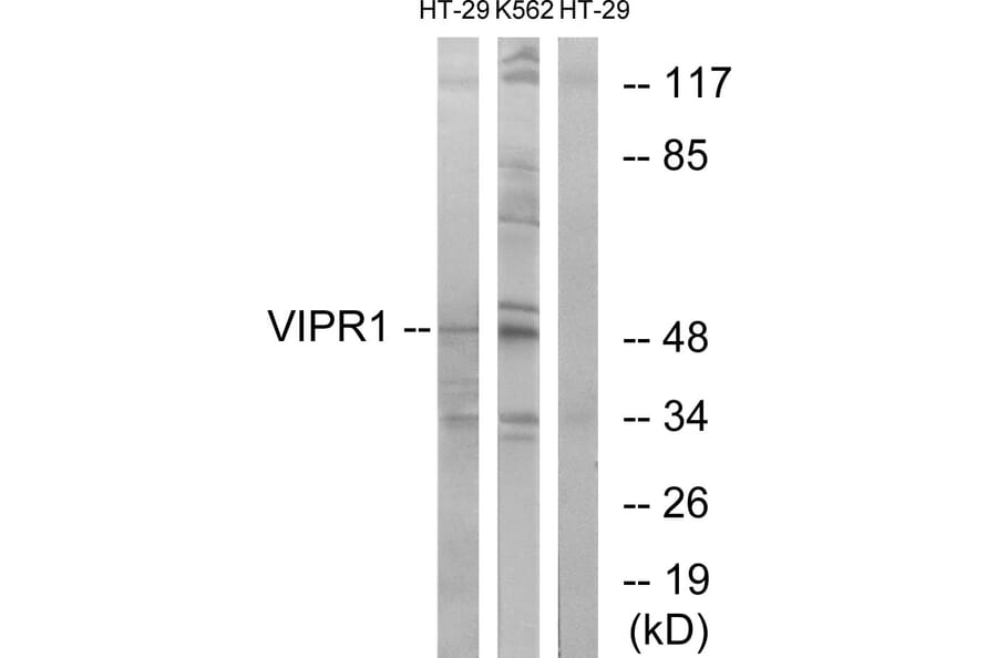 Western Blot - Anti-VIPR1 Antibody (G789) - Antibodies.com