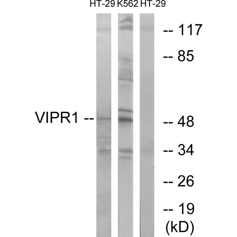 Western Blot - Anti-VIPR1 Antibody (G789) - Antibodies.com