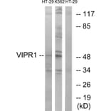 Western Blot - Anti-VIPR1 Antibody (G789) - Antibodies.com