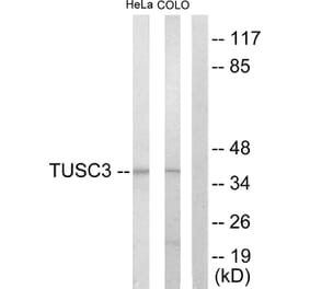 Western Blot - Anti-TUSC3 Antibody (C10978) - Antibodies.com