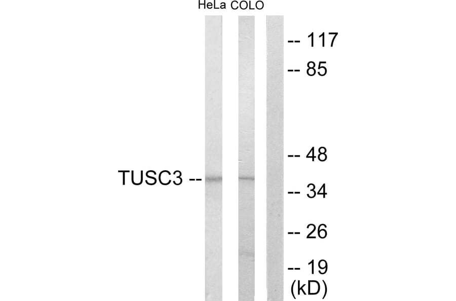 Western Blot - Anti-TUSC3 Antibody (C10978) - Antibodies.com