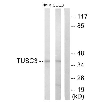 Western Blot - Anti-TUSC3 Antibody (C10978) - Antibodies.com