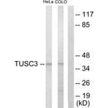 Western Blot - Anti-TUSC3 Antibody (C10978) - Antibodies.com