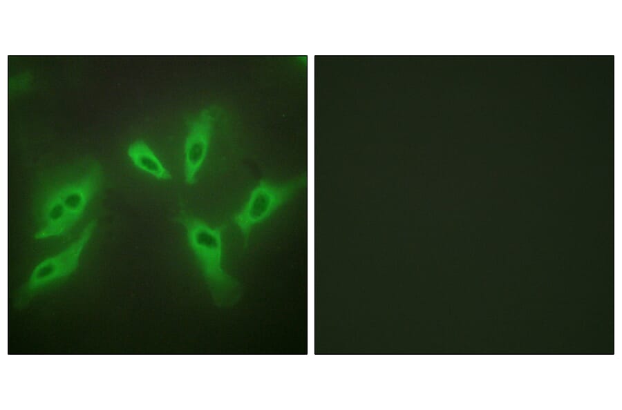 Immunofluorescence - Anti-TUSC3 Antibody (C10978) - Antibodies.com