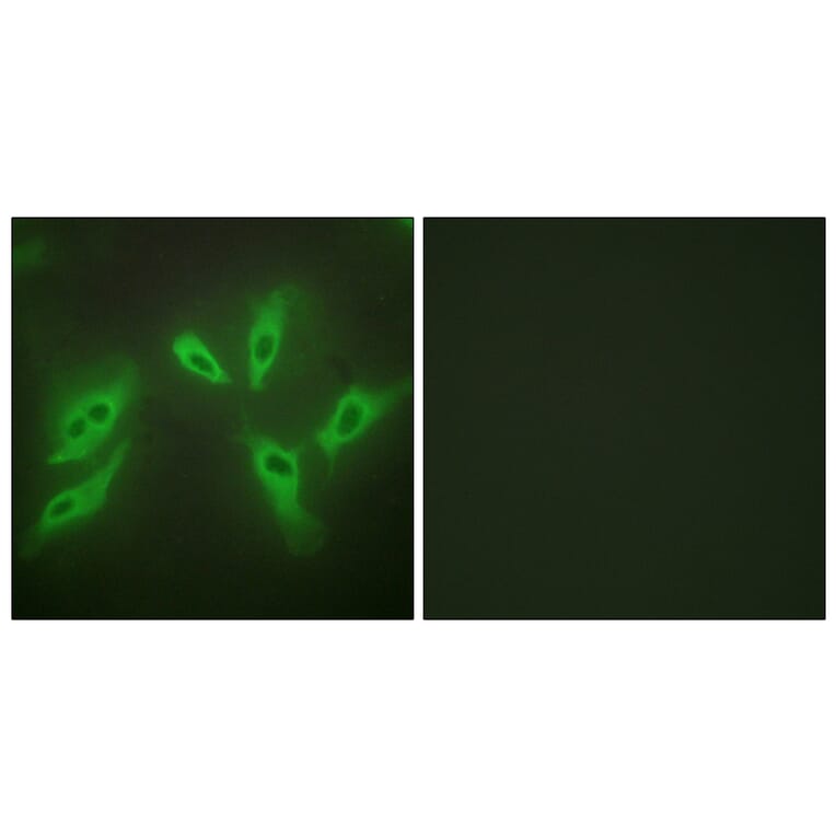 Immunofluorescence - Anti-TUSC3 Antibody (C10978) - Antibodies.com