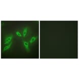 Immunofluorescence - Anti-TUSC3 Antibody (C10978) - Antibodies.com