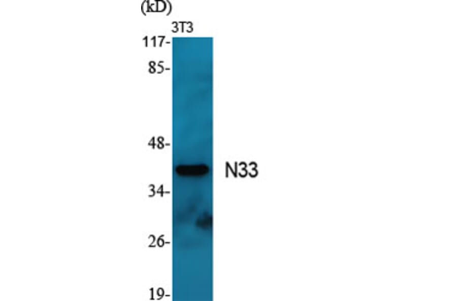 Western Blot - Anti-TUSC3 Antibody (C10978) - Antibodies.com