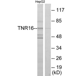 Western Blot - Anti-TNR16 Antibody (C10300) - Antibodies.com