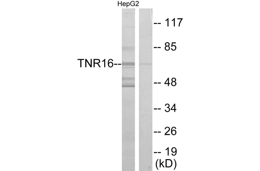 Western Blot - Anti-TNR16 Antibody (C10300) - Antibodies.com