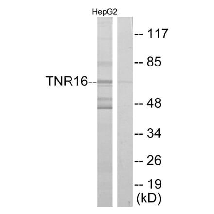 Western Blot - Anti-TNR16 Antibody (C10300) - Antibodies.com