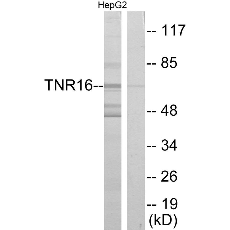 Western Blot - Anti-TNR16 Antibody (C10300) - Antibodies.com