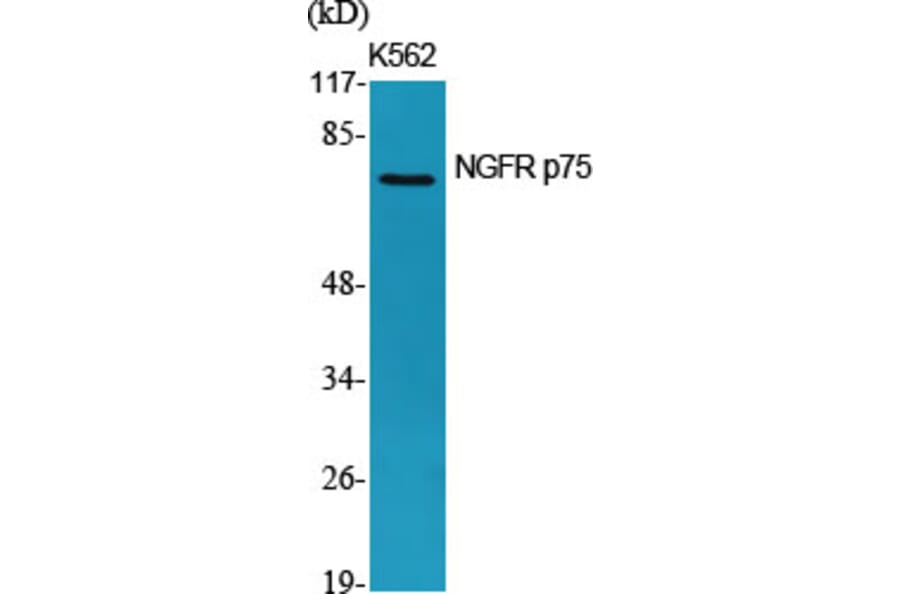 Western Blot - Anti-TNR16 Antibody (C10300) - Antibodies.com