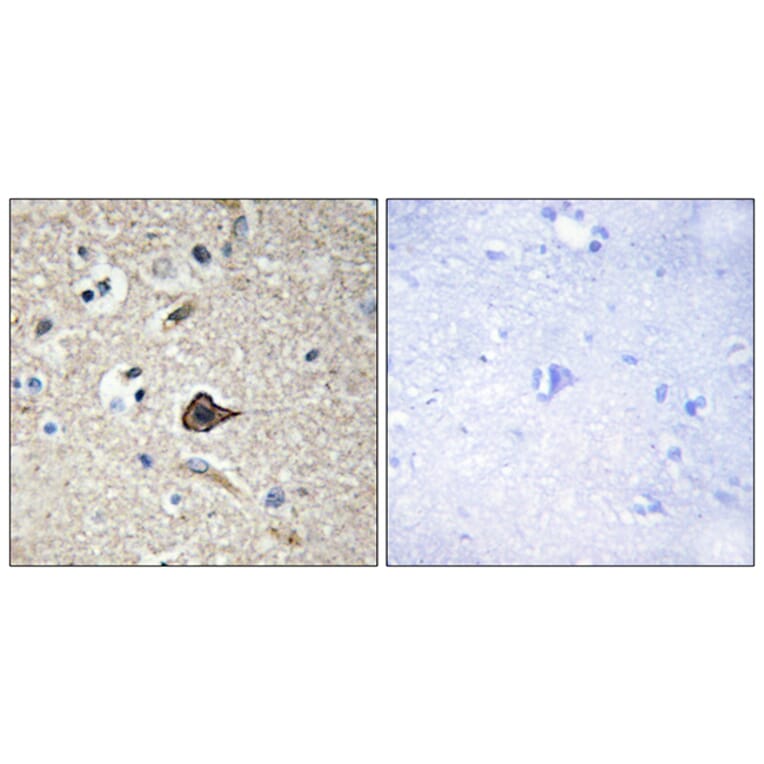 Immunohistochemistry - Anti-TNF12 Antibody (C10105) - Antibodies.com