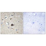 Immunohistochemistry - Anti-TNF12 Antibody (C10105) - Antibodies.com