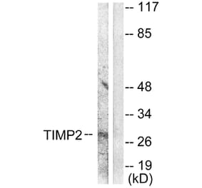 Western Blot - Anti-TIMP2 Antibody (C0348) - Antibodies.com