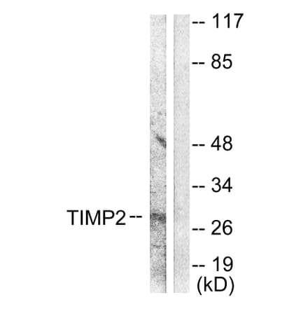 Western Blot - Anti-TIMP2 Antibody (C0348) - Antibodies.com