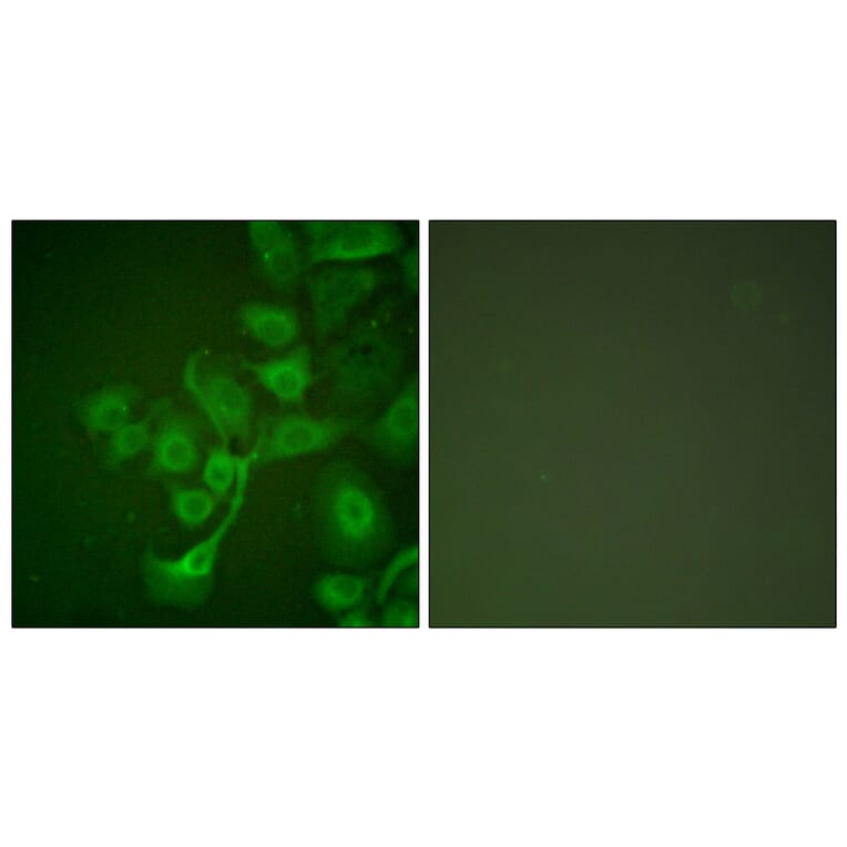 Immunofluorescence - Anti-TIMP2 Antibody (C0348) - Antibodies.com