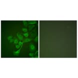 Immunofluorescence - Anti-TIMP2 Antibody (C0348) - Antibodies.com