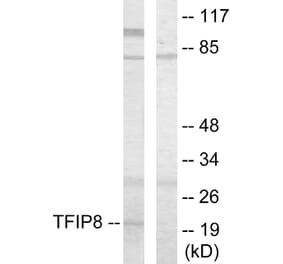 Western Blot - Anti-TFIP8 Antibody (C10226) - Antibodies.com