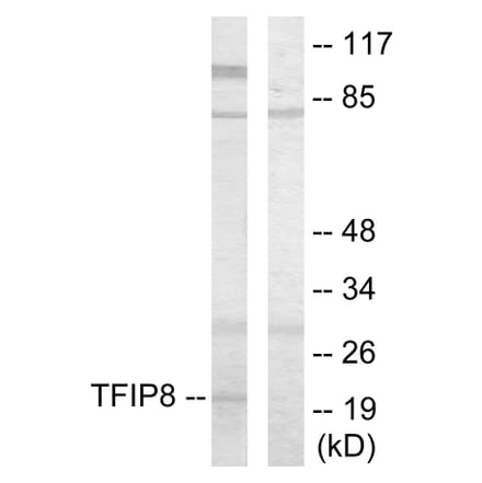 Western Blot - Anti-TFIP8 Antibody (C10226) - Antibodies.com