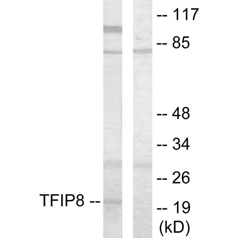 Western Blot - Anti-TFIP8 Antibody (C10226) - Antibodies.com