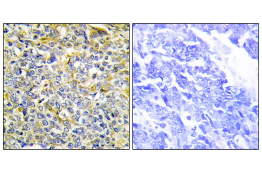 Immunohistochemistry - Anti-TFIP8 Antibody (C10226) - Antibodies.com