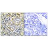 Immunohistochemistry - Anti-TFIP8 Antibody (C10226) - Antibodies.com