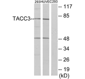 Western Blot - Anti-TACC3 Antibody (C19673) - Antibodies.com