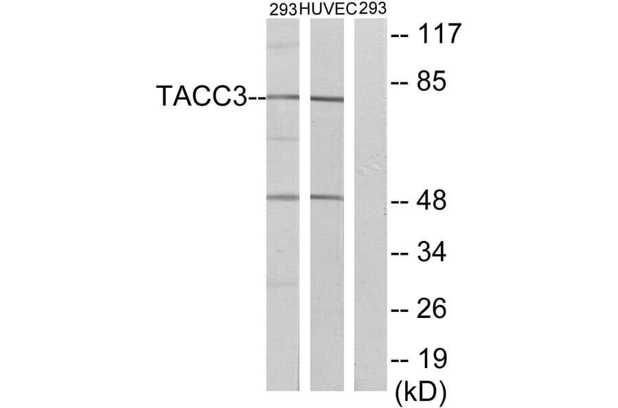 Western Blot - Anti-TACC3 Antibody (C19673) - Antibodies.com