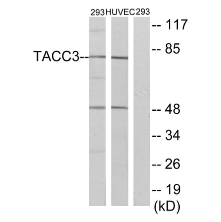 Western Blot - Anti-TACC3 Antibody (C19673) - Antibodies.com