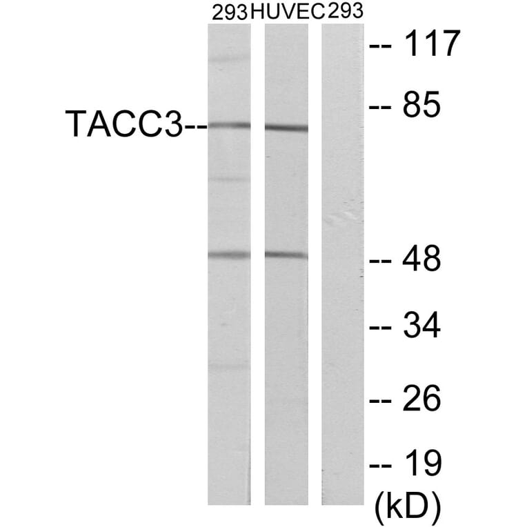 Western Blot - Anti-TACC3 Antibody (C19673) - Antibodies.com