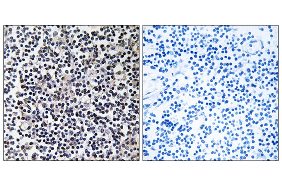 Immunohistochemistry - Anti-TACC3 Antibody (C19673) - Antibodies.com