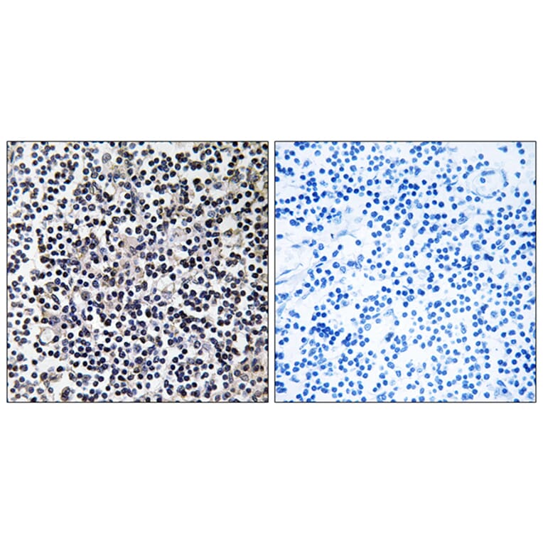 Immunohistochemistry - Anti-TACC3 Antibody (C19673) - Antibodies.com