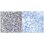 Immunohistochemistry - Anti-TACC3 Antibody (C19673) - Antibodies.com