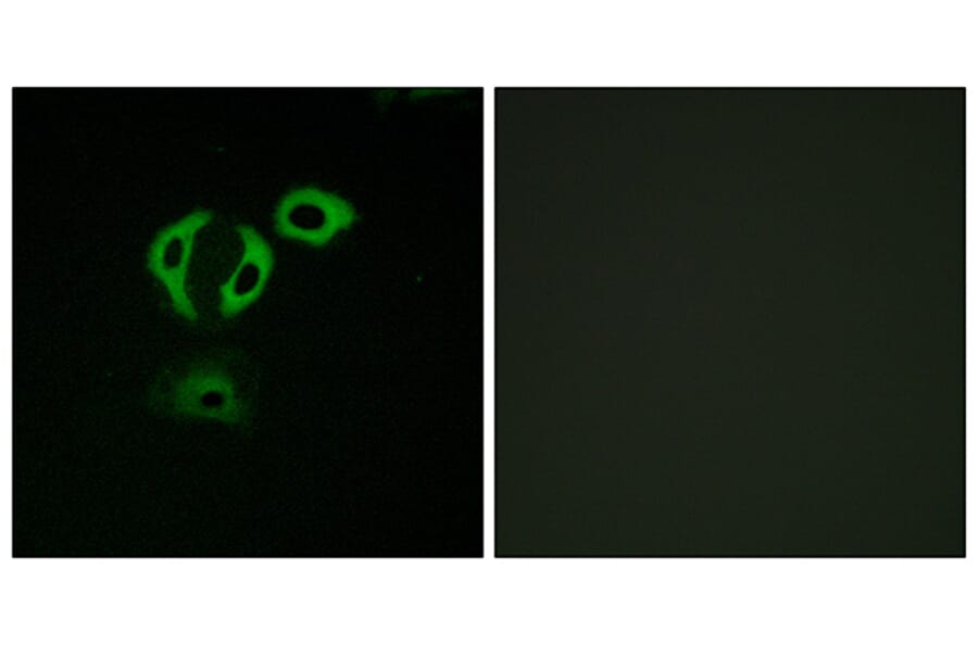 Immunofluorescence - Anti-TACC3 Antibody (C19673) - Antibodies.com