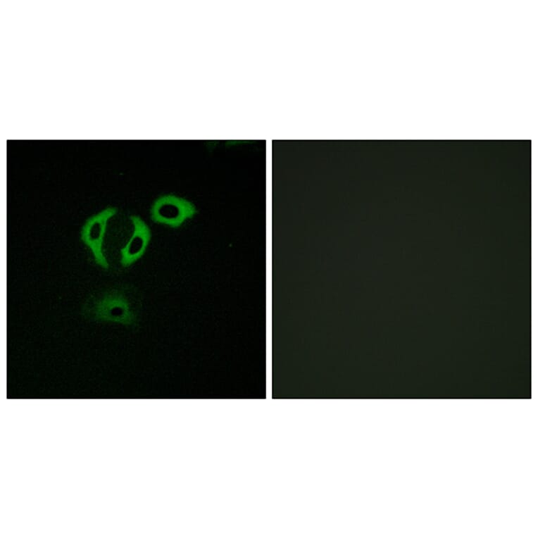 Immunofluorescence - Anti-TACC3 Antibody (C19673) - Antibodies.com