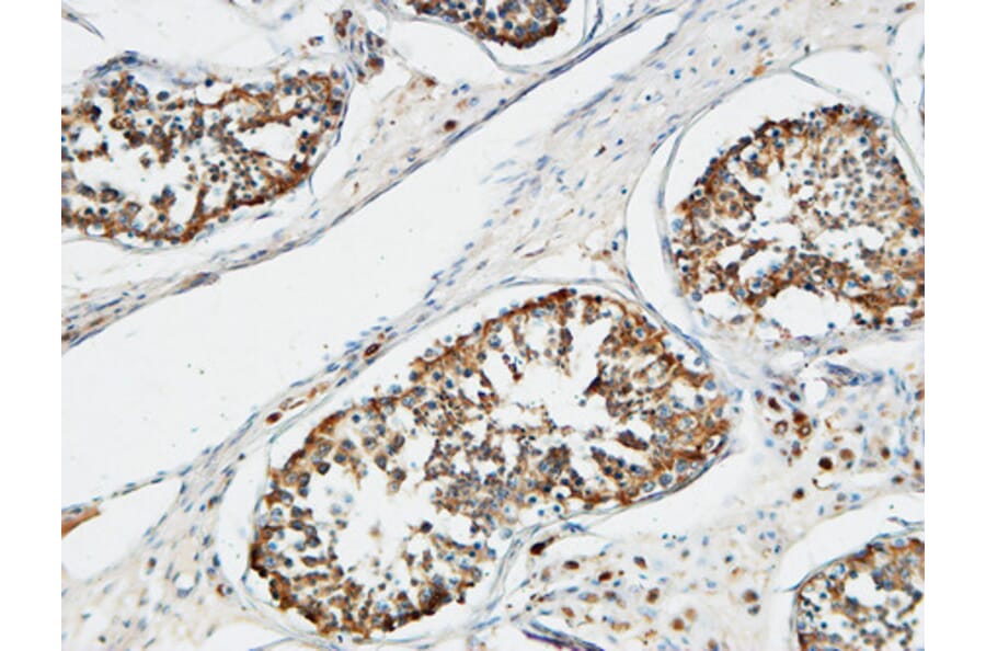 Immunohistochemistry - Anti-TACC3 Antibody (C19673) - Antibodies.com