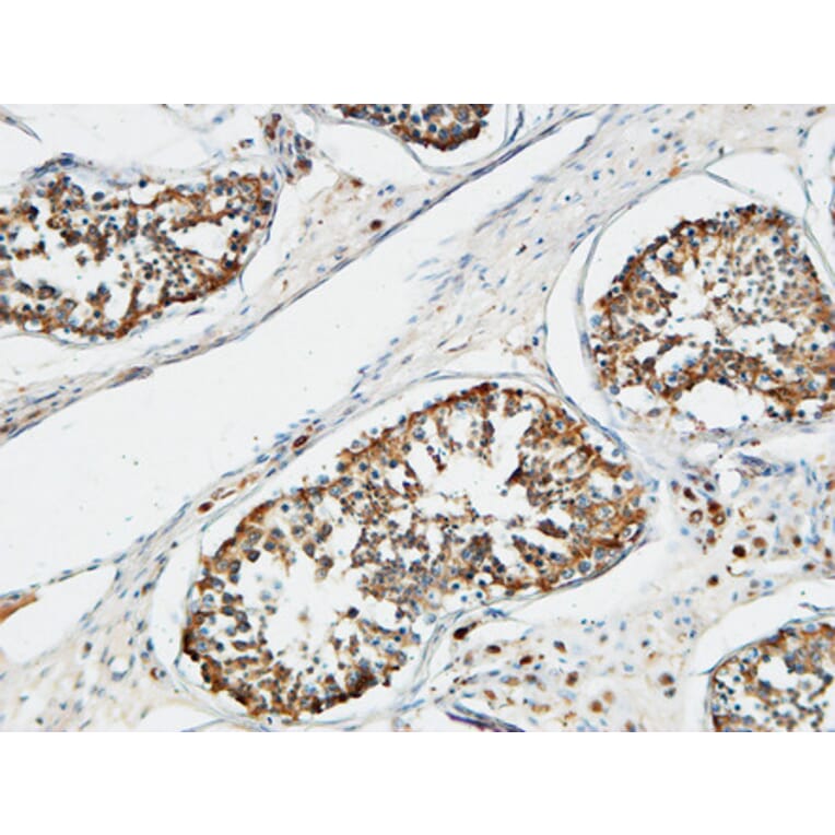 Immunohistochemistry - Anti-TACC3 Antibody (C19673) - Antibodies.com