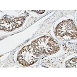 Immunohistochemistry - Anti-TACC3 Antibody (C19673) - Antibodies.com
