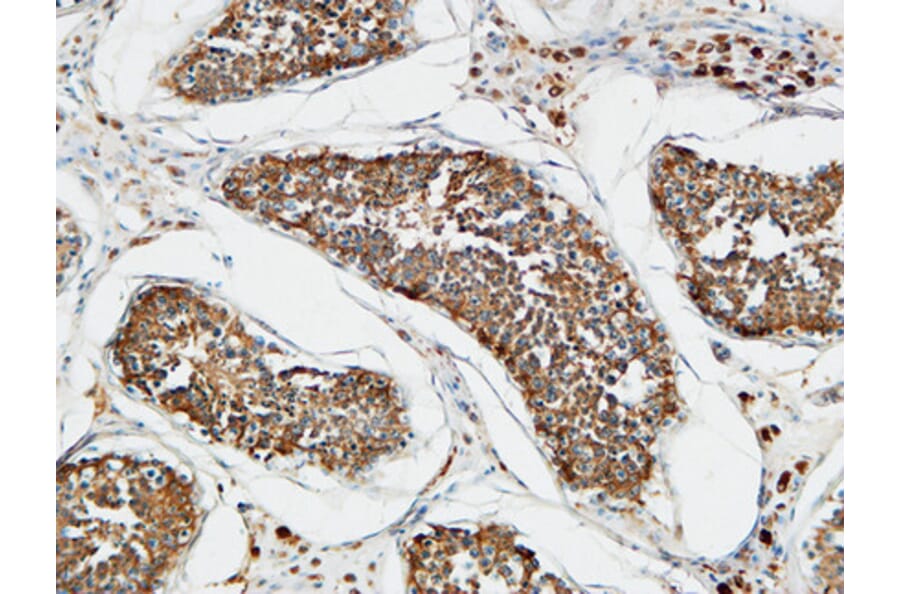 Immunohistochemistry - Anti-TACC3 Antibody (C19673) - Antibodies.com