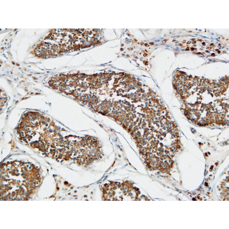 Immunohistochemistry - Anti-TACC3 Antibody (C19673) - Antibodies.com