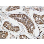 Immunohistochemistry - Anti-TACC3 Antibody (C19673) - Antibodies.com