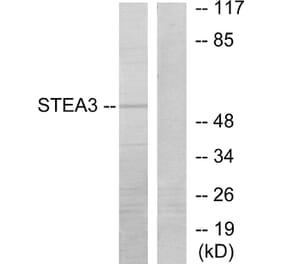 Western Blot - Anti-STEA3 Antibody (C11204) - Antibodies.com
