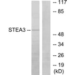 Western Blot - Anti-STEA3 Antibody (C11204) - Antibodies.com