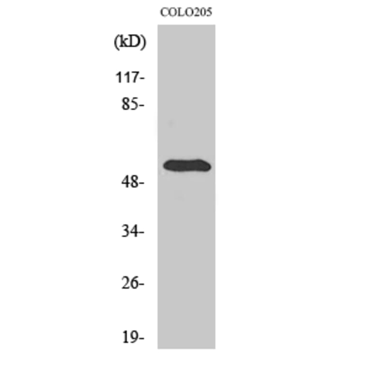 Western Blot - Anti-STEA3 Antibody (C11204) - Antibodies.com