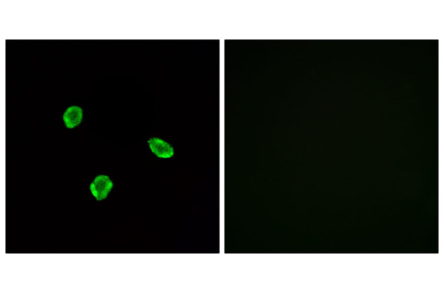 Immunofluorescence - Anti-SSTR1 Antibody (G744) - Antibodies.com