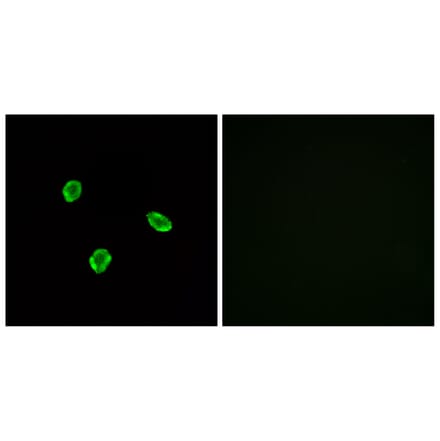 Immunofluorescence - Anti-SSTR1 Antibody (G744) - Antibodies.com