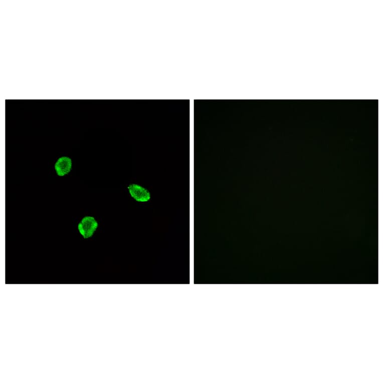 Immunofluorescence - Anti-SSTR1 Antibody (G744) - Antibodies.com