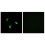 Immunofluorescence - Anti-SSTR1 Antibody (G744) - Antibodies.com